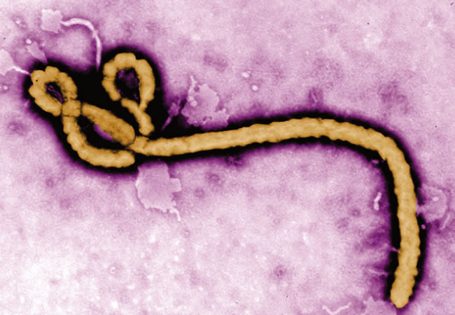 Imagen del virus del ébola. Foto: EFE