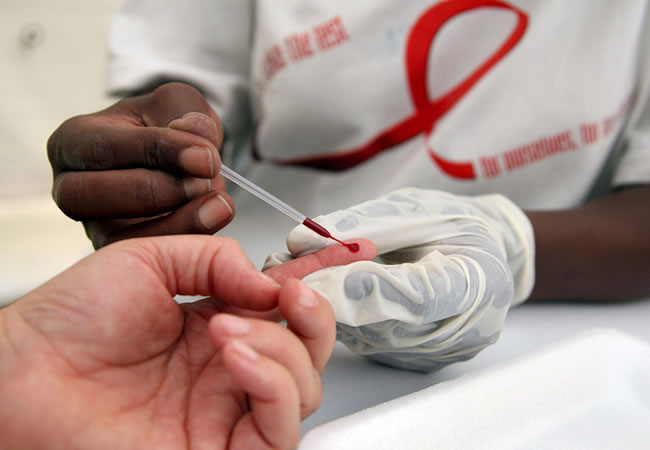 Casos de VIH y Sida. Foto: EFE