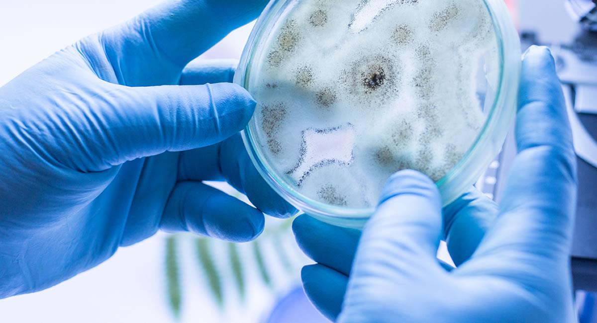 El hongo Candida auris es un microorganismo superresistente a los principales fármacos conocidos y potencialmente mortal. Foto: Shutterstock
