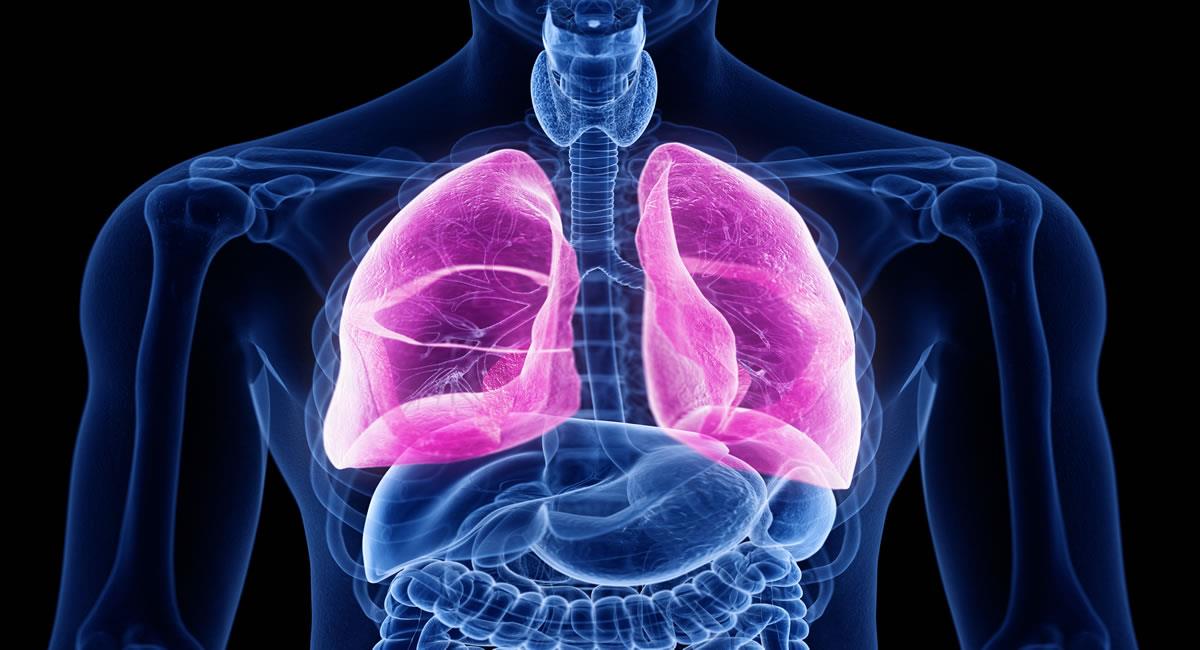 Ilustración de fibrosis pulmonar. Foto: Shutterstock