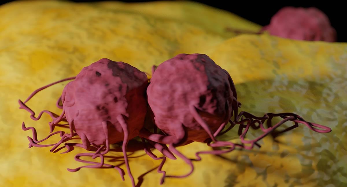 El estudio dan así respuesta a uno de los misterios en la investigación sobre le cáncer y puede tener implicaciones clínicas. Foto: Shutterstock