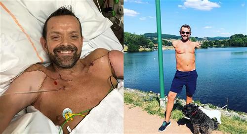 Félix, el primer hombre en recibir un trasplante doble de brazos