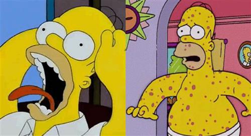 Viruela del mono: ¿'Los Simpson' predijeron la nueva enfermedad?
