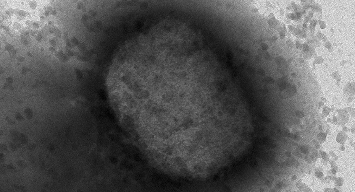 Virus de la viruela del mono por microscopía electrónica. Foto: EFE