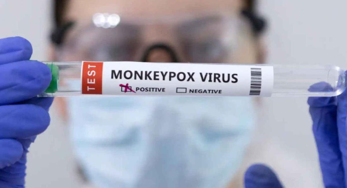 Bolivia acumula 14 contagios de la viruela del mono. Foto: Twitter