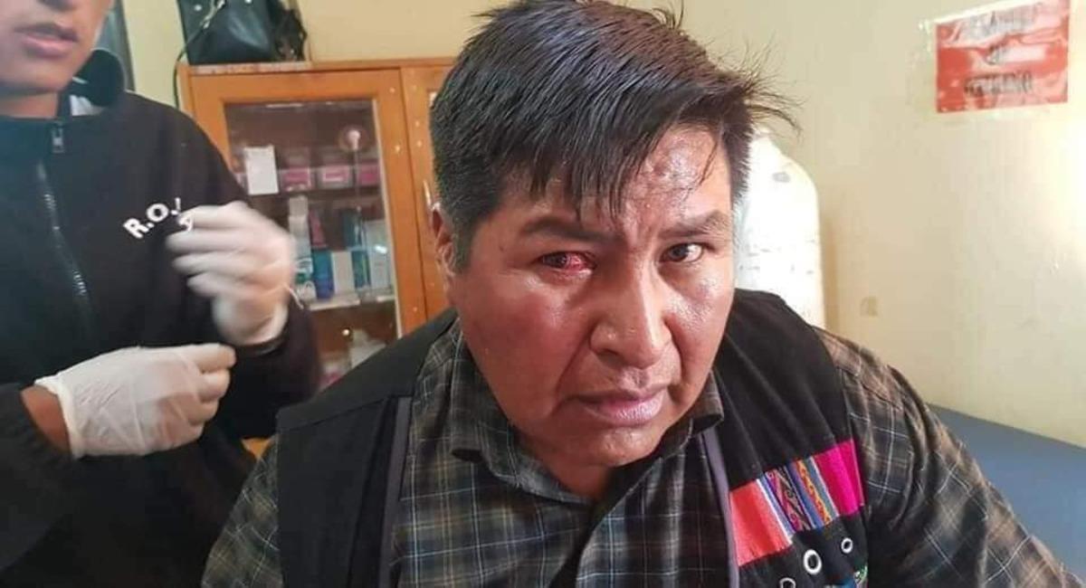 Martín Choque denunció haber sido golpeado por afines a Evo Morales tras el "desplante". Foto: Twitter @rtp_bolivia