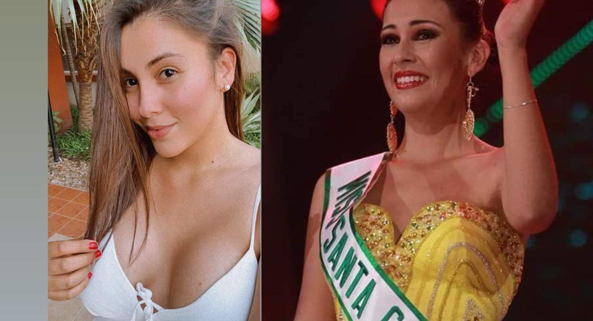 La ex Miss Santa Cruz 2013 fue diagnosticada con lupus, pero tras varias cirugías los médicos no tienen claro que tiene. Foto: Facebook Captura Infobo Bolivia