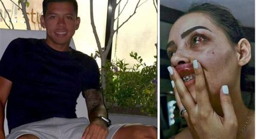 Señalan a futbolista de Real Santa Cruz de ataque contra su pareja 