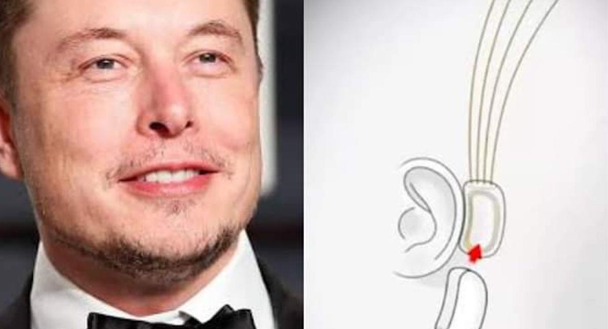 Elonk Musk reveló al mundo que la persona con el implante "tiene respuesta cerebral". Foto: Twitter @ElonMusk.